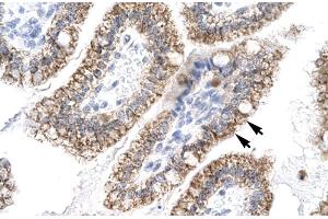 Human Intestine (AEBP1 anticorps  (N-Term))