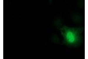 Anti-DCK mouse monoclonal antibody (ABIN2454431) immunofluorescent staining of COS7 cells transiently transfected by pCMV6-ENTRY DCK (RC210767). (DCK anticorps)