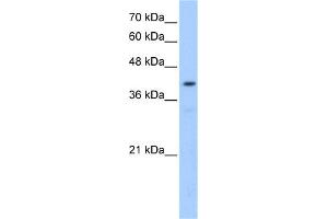 WB Suggested Anti-POMT2 Antibody Titration:  0.