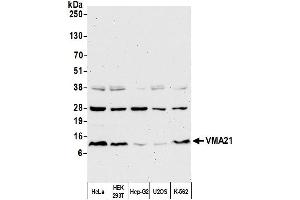 Western Blotting (WB) image for anti-Vacuolar H+-ATPase Homolog (VMA21) (AA 51-101) antibody (ABIN7452645)