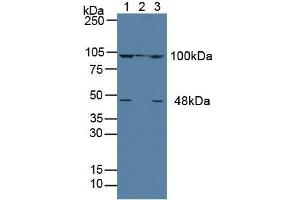 Western blot analysis of (1) Human MCF-7 Cells, (2) Porcine Liver Tissue and (3) Human HeLa cells. (alpha Actinin 4 anticorps  (AA 1-269))
