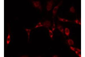 ABIN6274909 staining HeLa by IF/ICC.