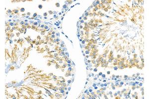 ABIN6257707 and ABIN6274332 at 1/100 staining Rat testis tissue by IHC-P. (CHAF1A anticorps  (N-Term))