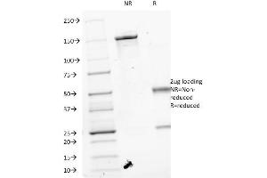 SDS-PAGE Analysis Purified VEGF Mouse Monoclonal Antibody (VEGF/1063). (VEGFA anticorps)