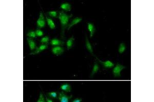 Immunofluorescence analysis of A549 cells using HEXIM1 Polyclonal Antibody (HEXIM1 anticorps)