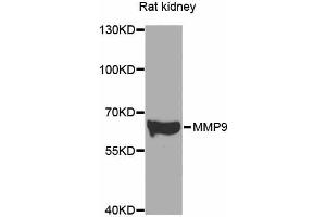 Western blot analysis of extracts of various cell lines, using MMP9 antibody (ABIN4904401) at 1:500 dilution. (MMP 9 anticorps)