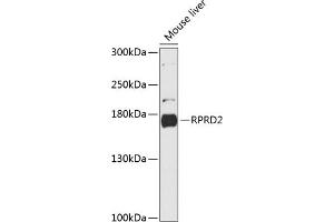 Western blot analysis of extracts of mouse liver, using RPRD2 antibody (ABIN6130674, ABIN6147187, ABIN6147188 and ABIN6216935) at 1:3000 dilution. (RPRD2 anticorps  (AA 1-350))