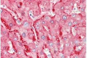 Human Liver: Formalin-Fixed, Paraffin-Embedded (FFPE) (ALDH1L1 anticorps)