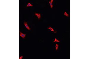 ABIN6268986 staining HeLa cells by IF/ICC. (Annexin A2 anticorps  (pSer26))