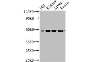 Western Blot Positive WB detected in: PC-3 whole cell lysate, Mouse kidney tissue, Mouse liver tissue, Rat brain tissue All lanes: ACP6 antibody at 3 μg/mL Secondary Goat polyclonal to rabbit IgG at 1/50000 dilution Predicted band size: 49, 31 kDa Observed band size: 49 kDa (ACP6 anticorps  (AA 35-324))