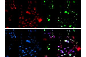 Immunofluorescence analysis of GFP-RNF168 transgenic U2OS cells using PIAS1 antibody (ABIN5973357). (PIAS1 anticorps)