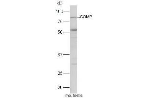 Mouse testis lysates probed with Rabbit Anti-COMP Polyclonal Antibody, Unconjugated  at 1:5000 for 90 min at 37˚C. (COMP anticorps)