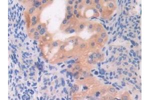 Detection of MB21D1 in Mouse Oviduct Tissue using Polyclonal Antibody to Mab21 Domain Containing Protein 1 (MB21D1)