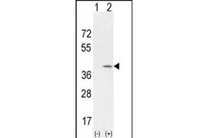 Western blot analysis of CCND1 (arrow) using rabbit polyclonal CCND1 Antibody (Center) (Cat. (Cyclin D1 anticorps  (AA 147-175))