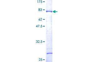 Image no. 1 for Sorting Nexin 15 (SNX15) (AA 1-342) protein (GST tag) (ABIN1320870)