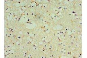 anti-Dopamine Receptor D3 (DRD3) (AA 213-329) antibody