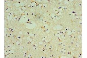 Immunohistochemistry of paraffin-embedded human brain tissue using ABIN7149475 at dilution of 1:100 (DRD3 anticorps  (AA 213-329))