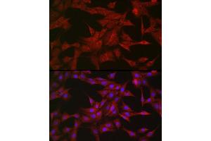Immunofluorescence analysis of PC-12 cells using SOCS3 Rabbit pAb (ABIN3015316, ABIN3015317, ABIN5663764 and ABIN6213984) at dilution of 1:50 (40x lens). (SOCS3 anticorps  (C-Term))
