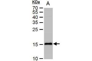 WB Image LC3B antibody detects LC3B protein by western blot analysis. (LC3B anticorps)