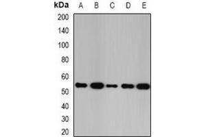 Western blot analysis of Glutathione Synthetase expression in SW480 (A), K562 (B), Raji (C), mouse kidney (D), mouse liver (E) whole cell lysates. (Glutathione Synthetase anticorps)