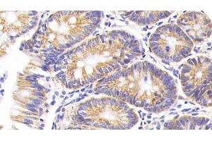 Detection of COX2 in Rat Colon Tissue using Polyclonal Antibody to Cytochrome C Oxidase Subunit II (COX2)