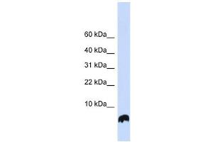 GLRX antibody used at 1 ug/ml to detect target protein. (Glutaredoxin 1 anticorps)