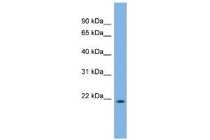 WB Suggested Anti-DCTD Antibody Titration: 0.
