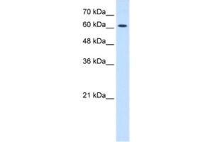 Western Blotting (WB) image for anti-Cholinergic Receptor, Nicotinic, epsilon (Muscle) (CHRNE) antibody (ABIN2463737) (CHRNE anticorps)