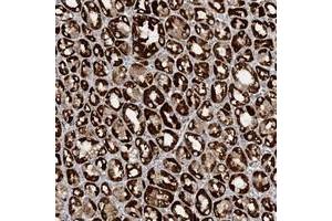 Immunohistochemical staining of human stomach with CCDC56 polyclonal antibody  strong cytoplasmic positivity in glandular cells at 1:500-1:1000 dilution. (CCDC56 anticorps)