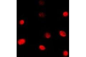 Immunofluorescent analysis of TBX1 staining in Jurkat cells.