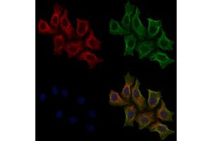 ABIN6255593 and ABIN6267543 staining HepG2 cells(30 min of 4uM Forskolin treatment) by IF/ICC. (Tuberin anticorps  (pThr1462))