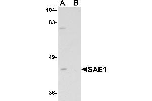 Western blot analysis of SAE1 in SK-N-SH lysate with SAE1 antibody at 1 µg/mL in (A) the absence and (B) the presence of blocking peptide. (SAE1 anticorps  (C-Term))