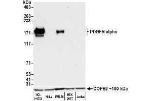 Western Blotting (WB) image for anti-Platelet Derived Growth Factor Receptor alpha (PDGFRA) (AA 24-525) antibody (ABIN7453344)