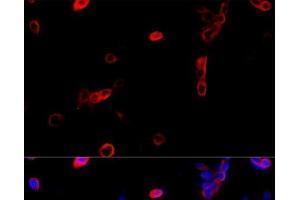 Immunofluorescence analysis of NIH/3T3 cells using ATP5B Polyclonal Antibody at dilution of 1:100 (40x lens).