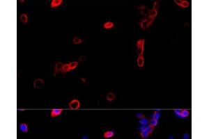 Immunofluorescence analysis of NIH/3T3 cells using ATP5B Polyclonal Antibody at dilution of 1:100 (40x lens). (ATP5B anticorps)