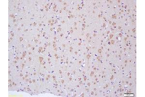 Formalin-fixed and paraffin embedded rat brain labeled with Anti-NF2/Neurofibromin 2 Polyclonal Antibody, Unconjugated  at 1:200 followed by conjugation to the secondary antibody and DAB staining (Merlin anticorps  (AA 401-550))