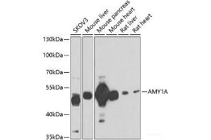 Western blot analysis of extracts of various cell lines using AMY1A Polyclonal Antibody at dilution of 1:1000. (AMY1A anticorps)