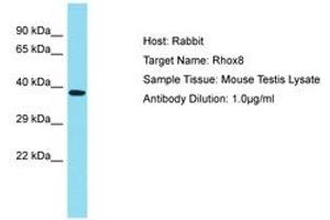 Image no. 1 for anti-Reproductive Homeobox 8 (RHOX8) (AA 180-229) antibody (ABIN6750292) (RHOX8 anticorps  (AA 180-229))