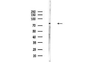 Western blot analysis of lysates from Hela cells(starvation,24h treatment), using MARK2 Antibody at 1/1000 dilution.