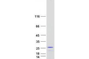 Validation with Western Blot