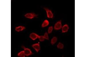 ABIN6275396 staining NIH-3T3 by IF/ICC. (Prosaposin anticorps  (Internal Region))