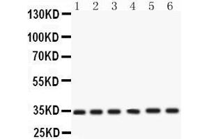 Western Blotting (WB) image for anti-Cyclin-Dependent Kinase 4 (CDK4) (AA 201-303) antibody (ABIN3043745) (CDK4 anticorps  (AA 201-303))