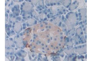 IHC-P analysis of Rat Pancreas Tissue, with DAB staining. (SLIT1 anticorps  (AA 611-791))