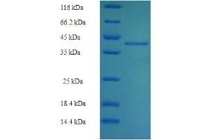 SDS-PAGE (SDS) image for NQO2 (NQO2) (AA 1-231), (full length) protein (His-SUMO Tag) (ABIN5711893)