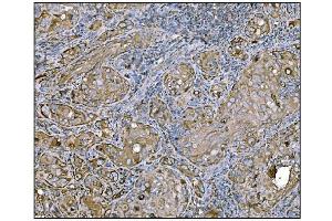 IHC analysis of HCCS using anti-HCCS antibody (ABIN7602424). (HCCS anticorps  (AA 76-268))
