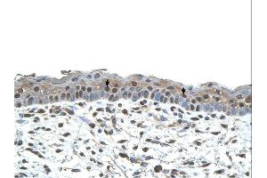 Immunohistochemistry (IHC) image for anti-Centromere Protein A (CENPA) (N-Term) antibody (ABIN2782448)