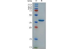 Cynomolgus C Protein, hFc Tag on SDS-PAGE under reducing condition.