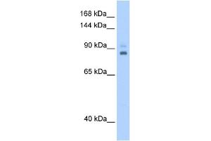 WB Suggested Anti-TPX2 Antibody Titration:  0. (TPX2 anticorps  (C-Term))