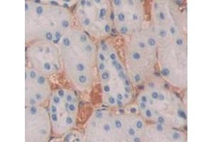 Used in DAB staining on fromalin fixed paraffin- embedded Kidney tissue (SEMA4D/CD100 anticorps  (AA 145-494))
