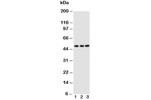 Western blot testing of CXCR4 antibody
